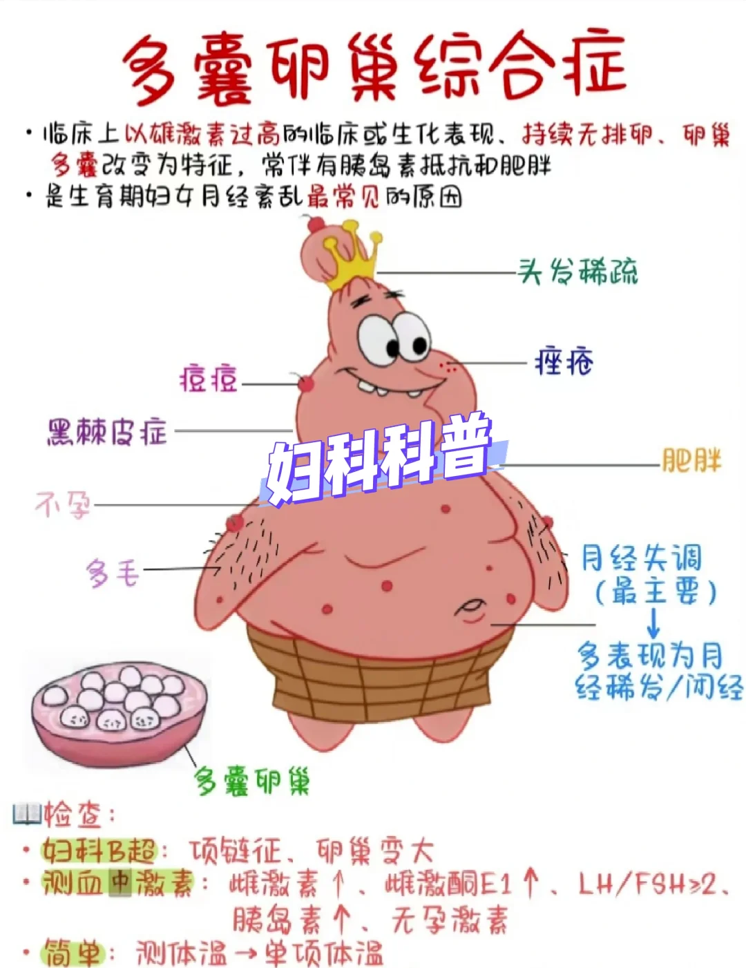多囊卵巢综合征的危害你知道吗？