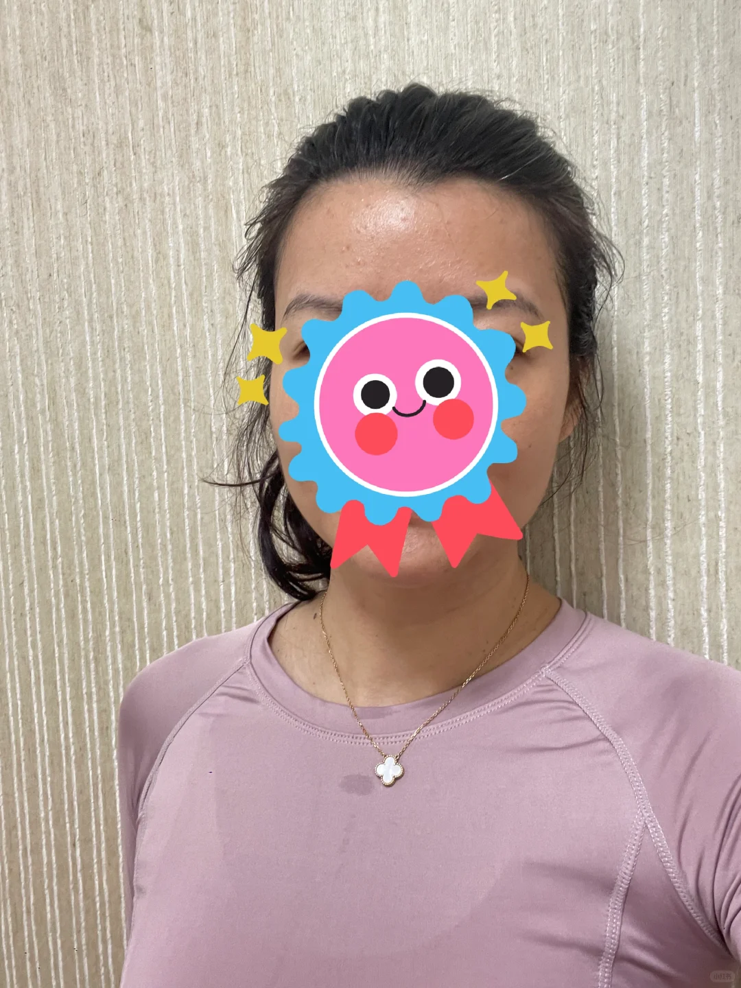 高龄促排，第四促