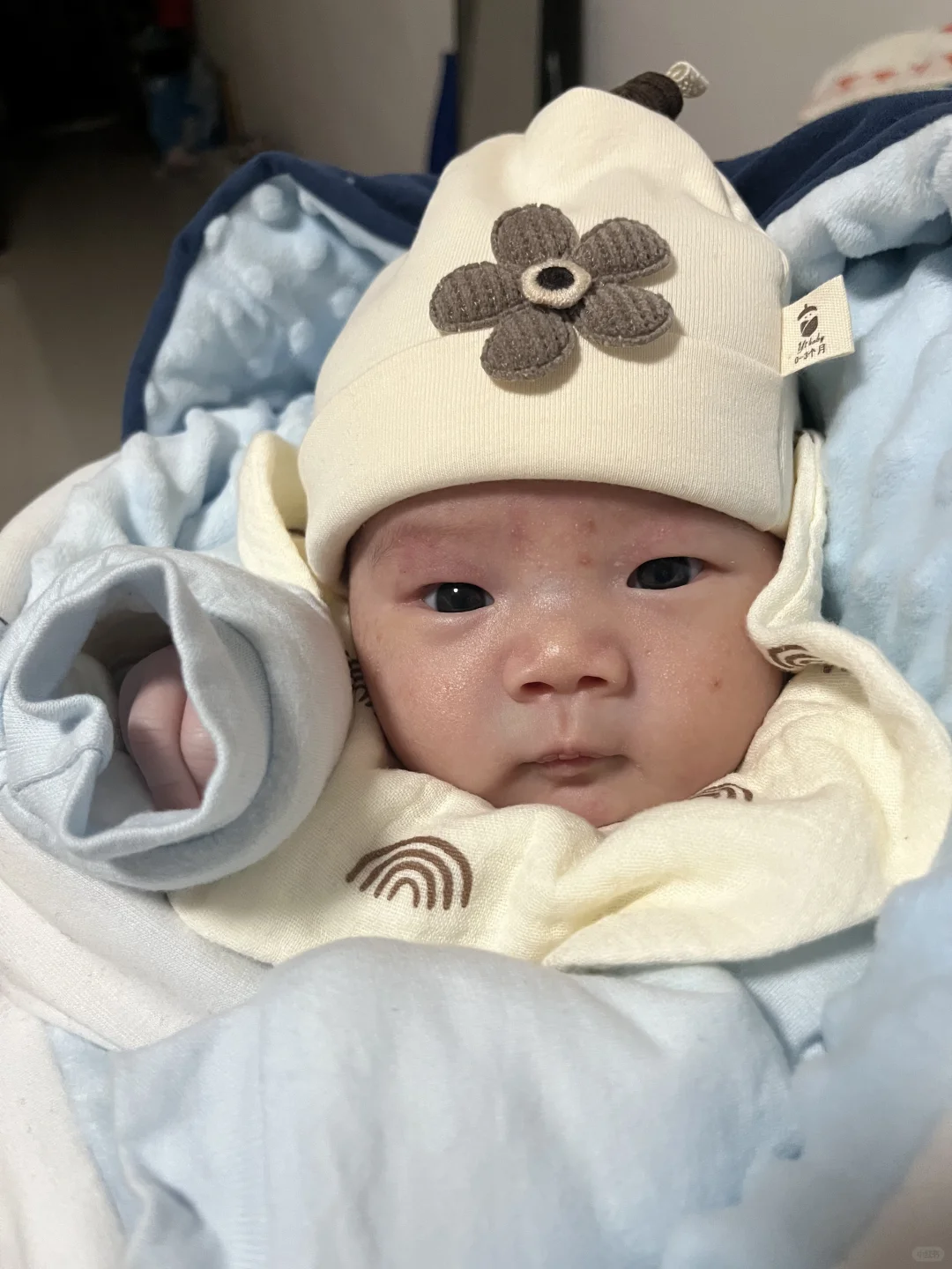<b>单脐动脉宝宝出生了 分享一期单脐动脉偏小</b>